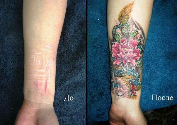 Перекрытие шрамов татуировкой на запястье